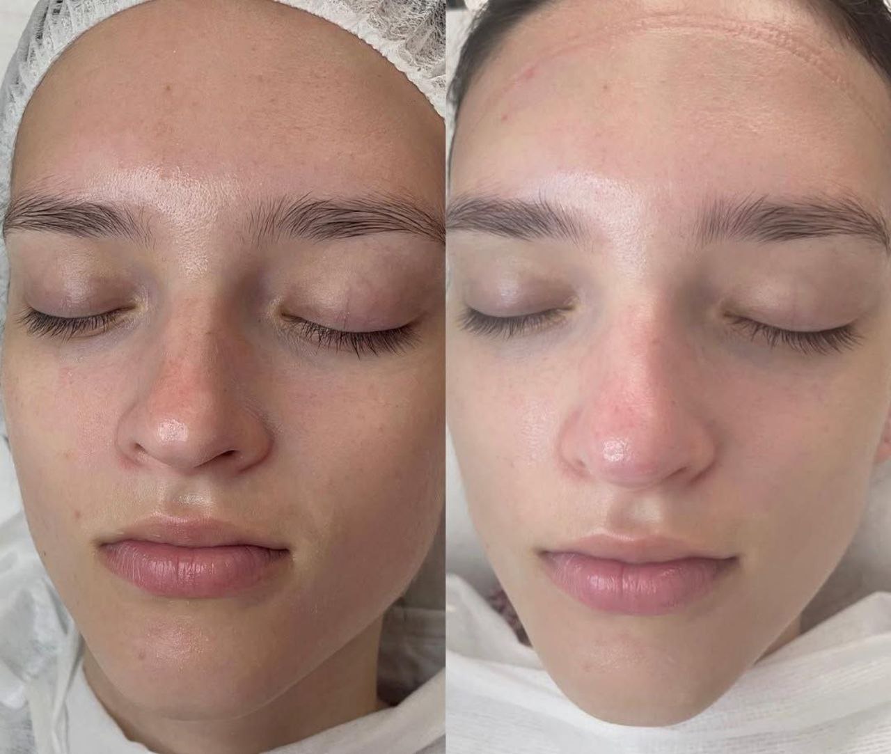 Пример практического применения авторского Skin Brightening — Фото № 9